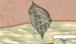 缝合视频教学,缝合技巧全解析